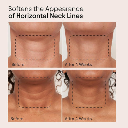 ALPYN Super Sculpt Serum, Face & Neck with Tri-Peptide Firming Complex, 1.7 oz