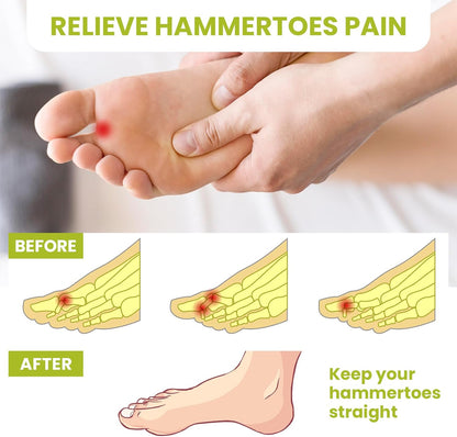 Bukihome Hammertoe Corrector Gel Toe Straighteners - 12 pcs Support Crest for Women & Men - Realign Bent, Crooked, Curled, Claw, Hammer Toes - Beige,Single Loop