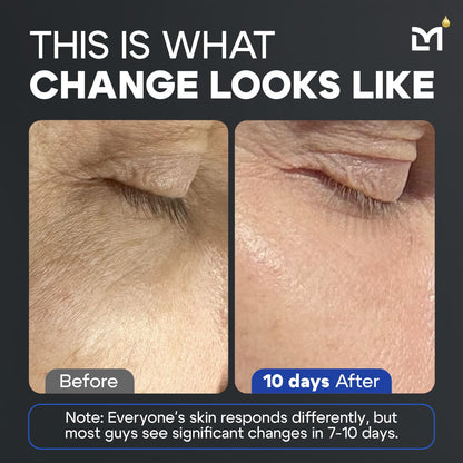 Titan Anti-Aging Peptides Serum for Face – High Potency Mens Peptide Serum Moisturizer – Mens Skin Care – Men, Dark Spots, Wrinkles, Fine Lines – Peptides, 5% Niacinamide, HA – Unscented