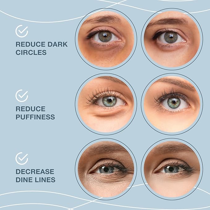 Under eye patches for puffy