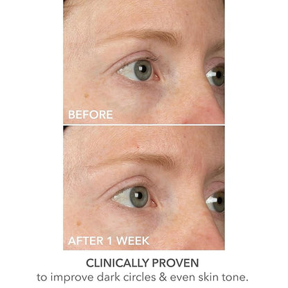 Dr dennis gross derminfusions lift