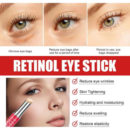 Retinol Eye Stick - Retinol Eye Cream, Under Eye Cream for Dark Circles, Eye Cream Anti Aging, Under Eye Corrector Reduces Fine Lines, Wrinkles and Puffiness, Results in 3-4 Weeks