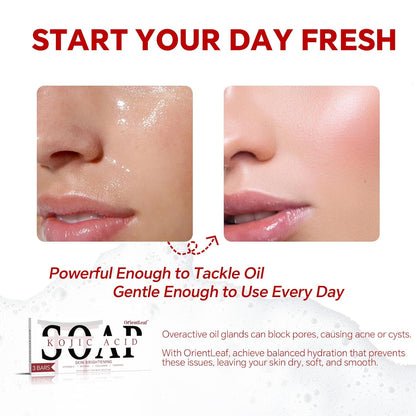 Kojic Acid Soap, Turmeric Soap Bar for Dark Spots, Fresh Citurs Scent, Gentle for Face and Body Wash with Vitamin C, Shea Butter, Retinol, Olive Oil, Collagen (3 PACK)