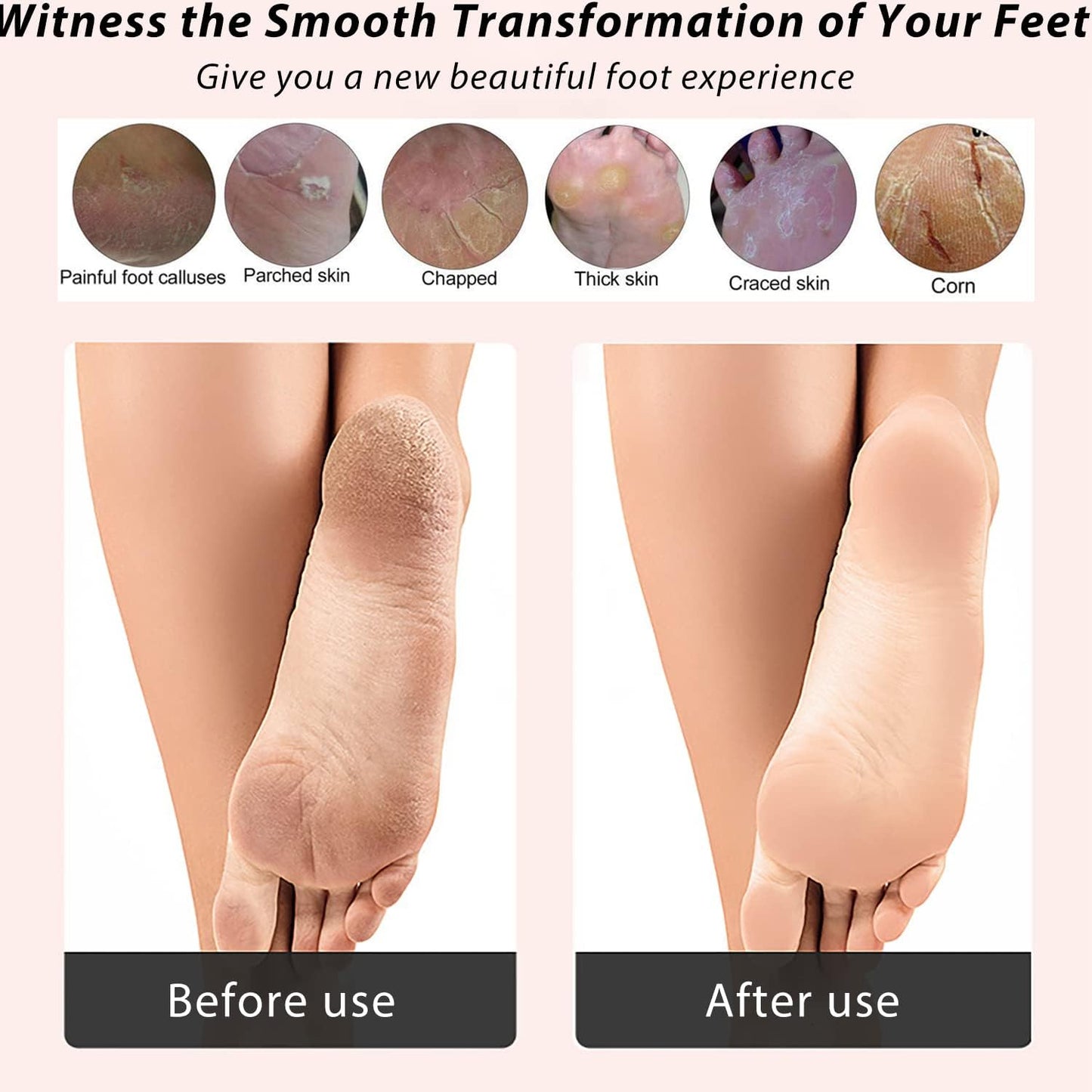 ICANdOIT-2 Packs Natural Bamboo Foot File Callus Remover-Multi Purpose 4 in 1 Feet Pedicure Kit with Boar Bristle Brush,Pumice Stone,Foot Rasp,Sand Paper