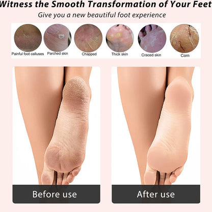 ICANdOIT-2 Packs Natural Bamboo Foot File Callus Remover-Multi Purpose 4 in 1 Feet Pedicure Kit with Boar Bristle Brush,Pumice Stone,Foot Rasp,Sand Paper