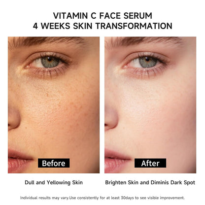 Vitamin C Face Serum with Glutathione, Hyaluronic Acid & Aloe Vera – Lightweight Brightening & Hydrating Ampoule for Daily Skincare, Dark Spots, Sensitive Skin Friendly - (1.0 ml)*30 Vials