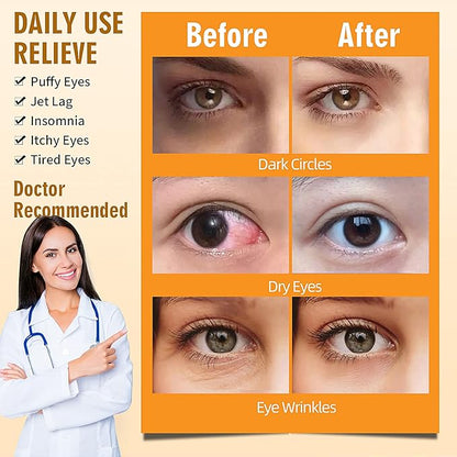 Serfeymi 10 packs steam eye