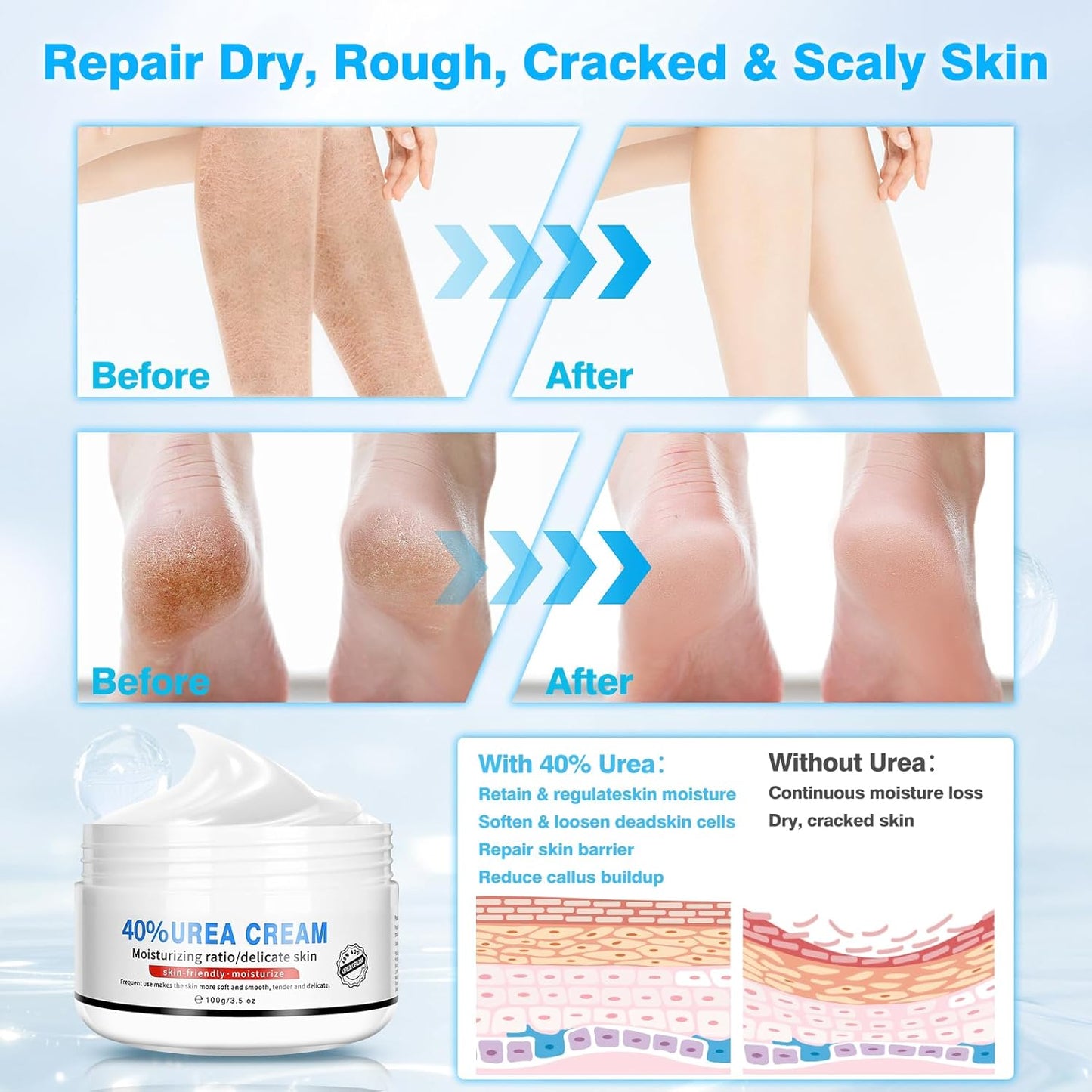 Urea Cream 40 Percent for Feet Maximum Strength, with Moisturizing Heel Socks for Cracked Heel,Foot Cream for Dry Cracked Heels and Feet,Urea Lotion, 3.5 OZ, Foot Files