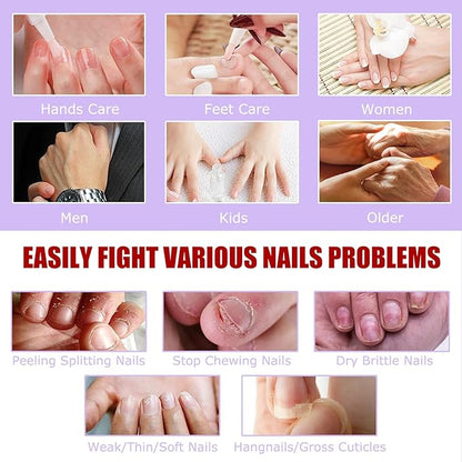 15 PCS Cuticle Oil for