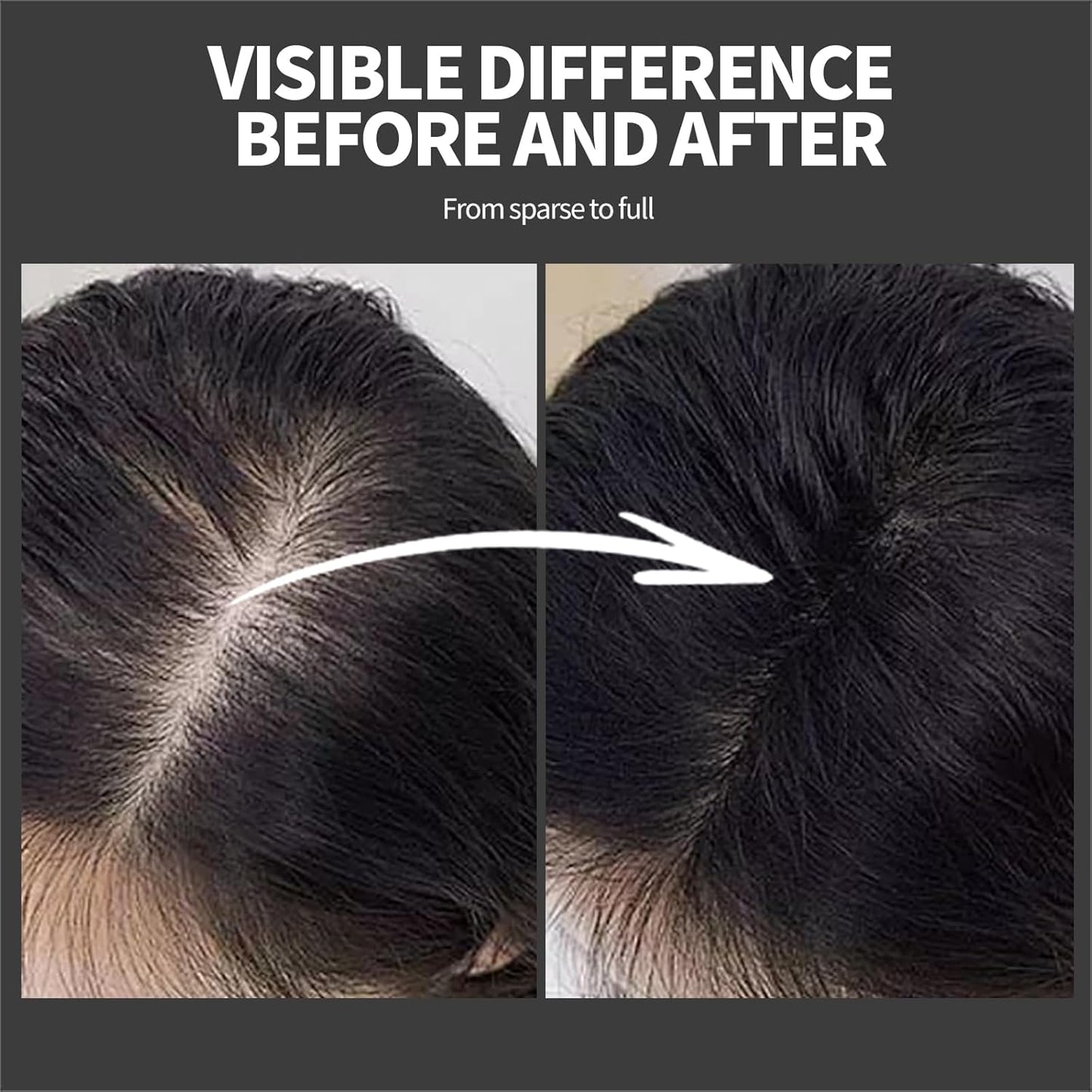 Hair Building Fibers 25G with Precision Spray Applicator - Electrostatic Adsorption for Instant Thicker Hair, Waterproof & Natural Look, Suitable for Men & Women (Medium brown)