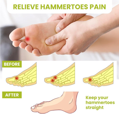 Bukihome Hammertoe Corrector Gel Toe Straighteners - 12 pcs Support Crest for Women & Men - Realign Bent, Crooked, Curled, Claw, Hammer Toes - Clear,Multi-Size