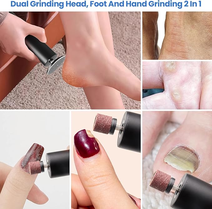 Electric callus remover for feet,