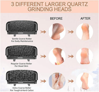 Callus removers 8 pack replacement