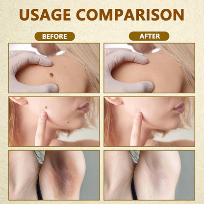 Bee Venom Skin Restoration Cream, Bee Venom Skin Treatment Cream, Repair and Wrinkle Reducing Comprehensive Moisturizer for All skin Types 2PC