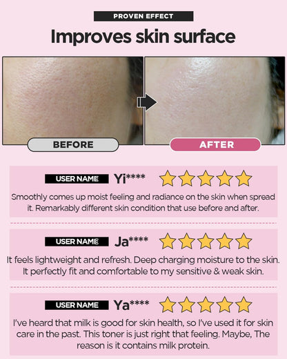 SKINRxLAB MadeCera Cream Double Essence Korean Toner 150ml (5.07fl.oz.) - Hydrating and Soothing with Milk Protein, Ceramide, Beta-Glucan - Moisturizing Strawberry Milky Toner for Irritated Skin