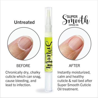 Cuticle Oil for Nails –