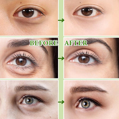 30 Pairs Gold Eye Mask,Under Eye Patches for Dark Circles and Puffiness,Relieves Water Bloating,Reduces Eye Bags and Smoothes Frownies,Eye Treatment Patches,Skin Care Products