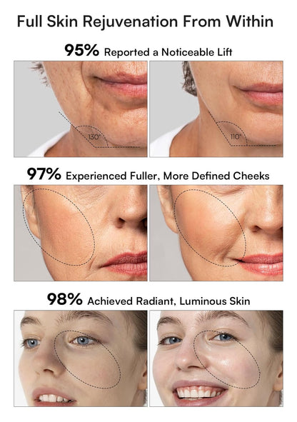 INIA 3-in-1 Red Light Therapy for Face and Neck, Skin Tightening Device True Beauty Glow Facial Massager for Skin Care, Effective Wrinkle Reduction Anti-Aging with Lifting, Tightening, Infusing