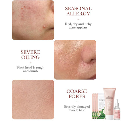 Camellia Extract Skin Care Sets, Skin Care Gift Set for Women Girls, Face Skin Care Routine Kit for Women, 5Pcs Skin Care Products Set with Cleanser,Mask, Face Serum