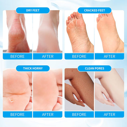 Pedicure Kit Foot Soak Set: Bubble Salt, Sugar Scrub, Massage Mask, Massage Lotion in a Box, 4 Step Foot Spa Kit for Dry Feet, Softens Calluses(1 Set Pacific Waves)