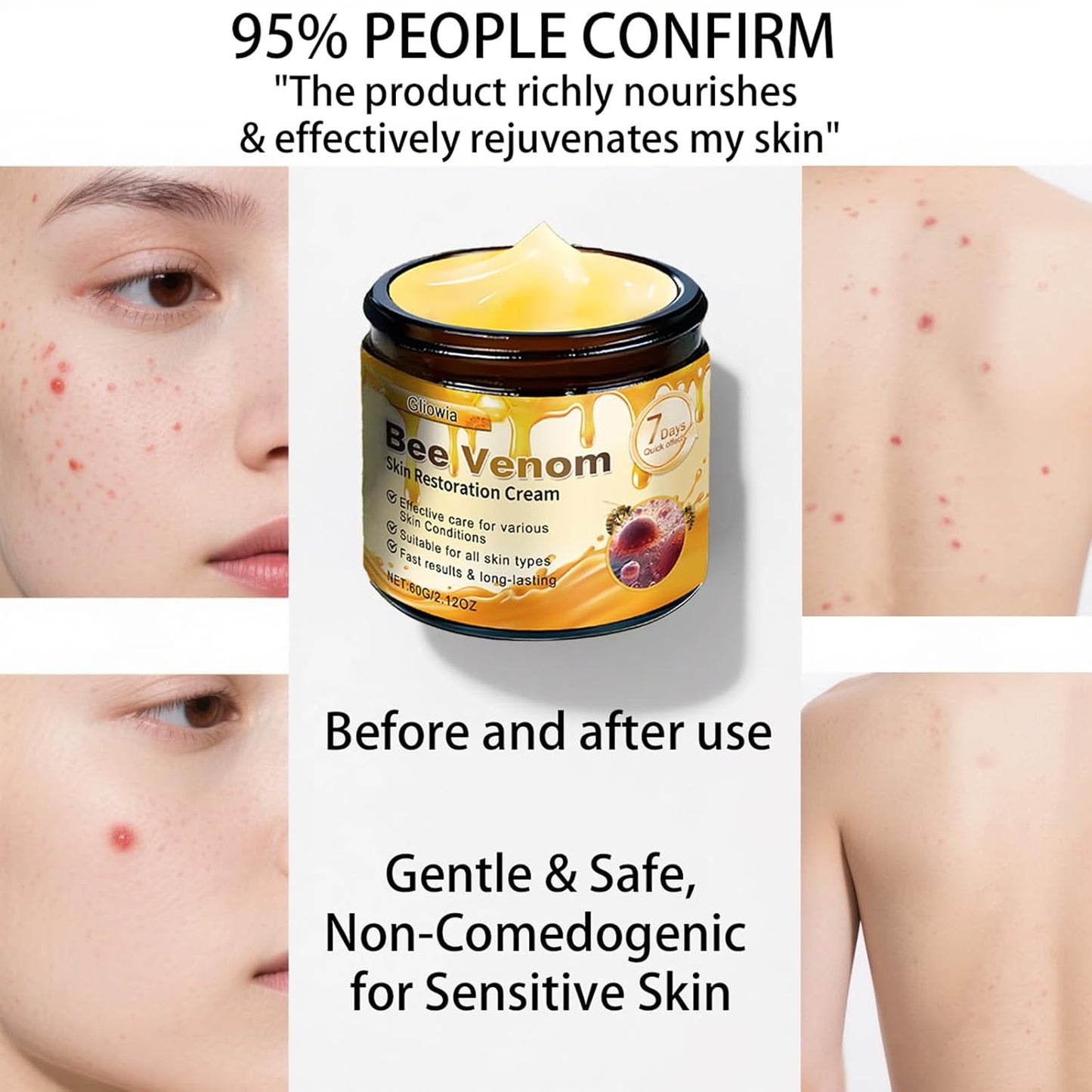 Bee Venom Skin Restoration Cream, 2025 Upgrade Bee Venom Skin Treatment Cream, Natural bee venom Comprehensive cream for Repair & Renewal, All in One Nourishing Serum for All Skin Types