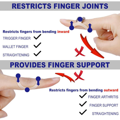 8Pcs Oval Finger Splints & Click-Lock Adjustment Kit, 4 Graduated Finger Ring Splint & 4 Splint Adjustment, Finger Braces for Arthritis, Mallet, Straightening, Support (Size 1-4)