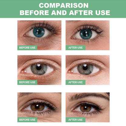 60 PCS Aloe Vera Eye Masks, Gel Collagen Under Eye Patches for Puffy Eyes and Dark Circles Treatments, Reduce Wrinkles and Fine Lines Undereye Patches