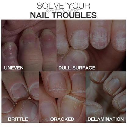 Base Top Coat Nail Polish: 3 in 1 Clear Quick Dry Nail Polish Nail Strengthener and Growth Hardener for Nail Treatment Repair Damaged Nail Care 0.5 fl oz