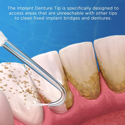 Replacement Tips for Waterpik Water Flosser (6 Implant Denture Tips)