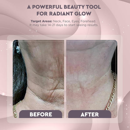 GLO24K Red Light Beauty Device for Face & Neck – 2-Pack, 3-in-1 Facial and Neck Massager with Triple LED & Vibration Technology