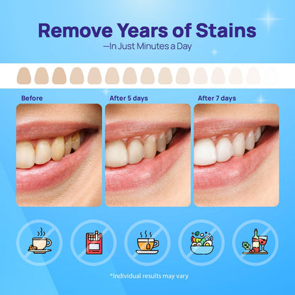 Whitebite Pro Upgraded Teeth Whitening Strips 28 Strips (14 Treatments) | Enamel-Safe | Deep Stains Removal | Non-Slip Design | Whitening Without Any Harm | Mint