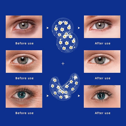 Gel ice pack reusable cooling