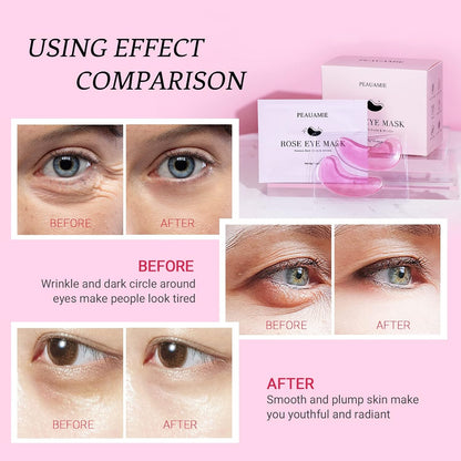 Under Eye Patchs Rose Eye Mask for Dark Circles and Puffiness Wrinkle Eye Bags 30 Pairs