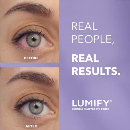LUMIFY Redness Reliever Eye Drops, for Whiter & Brighter Looking Eyes, 0.17 Fl Oz (5 mL)
