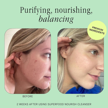 Brandefy Superfood Face Wash, Gentle & pH Balanced Cleanser w/Kale, Green Tea, Spinach, Vitamin C, E, K2- Softens & Nourishes Skin, Organic Facial Cleanser for All Skin Types (8 Fl Oz)