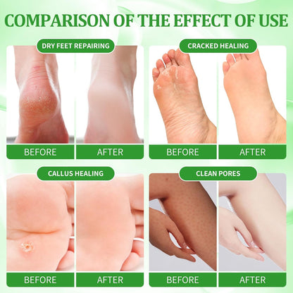 Pedicure Kit Foot Soak Set: Bubble Salt, Sugar Scrub, Massage Mask, Massage Lotion in a Box, 4 Step Foot Spa Kit for Dry Feet, Calluses and Tired Feet(3 Set Olive)