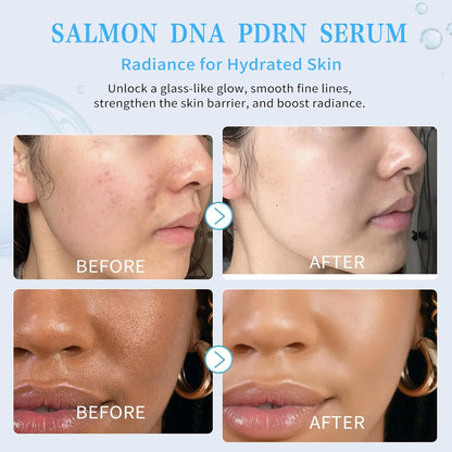 Salmon DNA PDRN Peptide Serum | 99% Salmon DNA PDRN Intensive Ampoule | Peptide, Collagen, Hyaluronic Acid, Niacinamide - Uneven Skin Tone, Anti-Aging, Moisturizing | Korean Skincare 0.05 fl oz x 30e