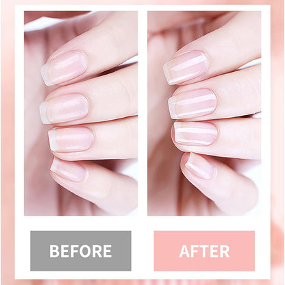 4in1 Nail Hardener Nail Strengthener Nail Rescue Calcium Primer for Thin Nails Growth Nail Repair Nail Care Kit with Cuticle Oil Cuticle Remover Gel Cream