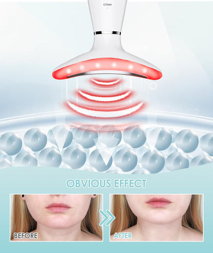 7 Color Neck Face Massager - Facial Massager Tool for Skin Care at Home, Vibrating Face Massager with Thermals, Galvanic Machines White