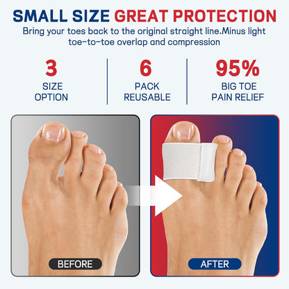 Big Toe Spacers,Hallux Valgus Corrector,Relieve Bunion Pain,Prevent Overlapping Toes, All-Day Comfort for Men & Women, Fits in Shoes.