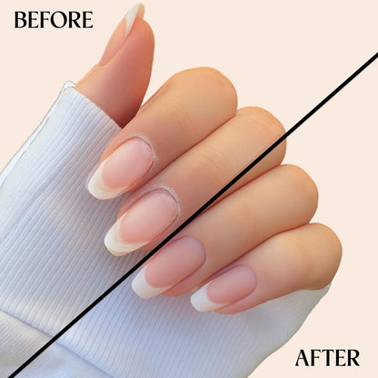 C CARE Pomegranate and Fig Cuticle Oil For Nails - Repairs Cuticles Overnight - Moisturizes and Strengthens Nails and Cuticles - Dropper & Brush included - 2.5oz