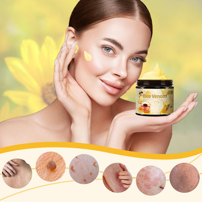 2pcs Bee Venom Treatment, New Professional Bee Venom Repair Cream, Bee Venom Cream for All Body Parts