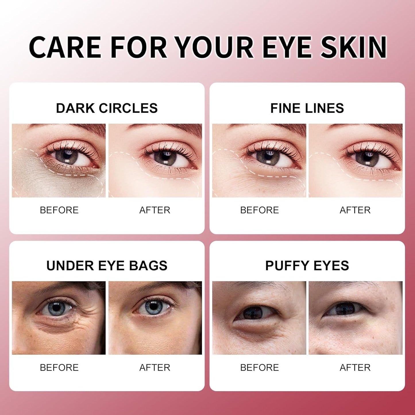 ROUSE Under Eye Patches-60 PCS-Pomegranate Eye Masks Anti-Wrinkle Eye Treatment Mask for Dark Circles Puffy Eyes Under Eye Bags Eye Gel Pads Eye Care