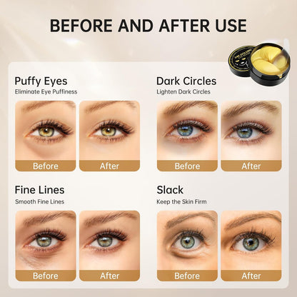 Under Eye Patches for Dark Circles, Eye Masks for Puffy Eyes Wrinkles Under Eye Bags Firmness 30 Pairs Skin Treatment Pads with Hyaluronic Acid and Collagen Gifts for Women Men (Gold)