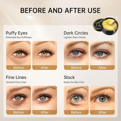 Under eye patches for dark