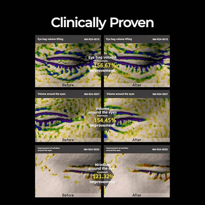 Eyephalt eyebag cream for puffiness,