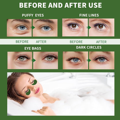 Under Eye Patches for Puffy Eyes 70PCS, Seaweed Eye Mask for Dark Circles and Puffiness, Under Eye Mask Patches Skincare, Eye Gel Pads, Eye Patches for Wrinkles, Puffy Eyes Bags Treatment Women Men