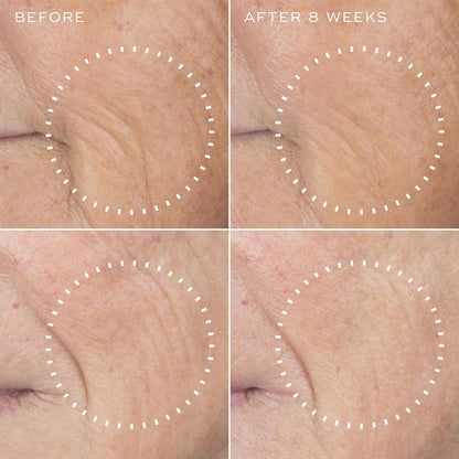 Medik8 Liquid Peptides Advanced MP - Peptide Serum - Face Serum for Wrinkle Reduction - Hydrating and Supports Collagen, Hyaluronic Acid - 1 oz