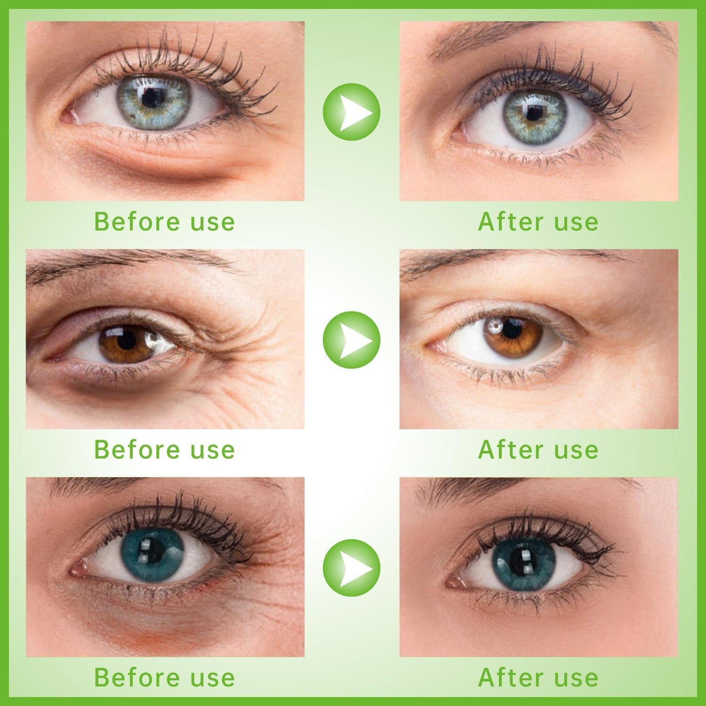 Gel Eye Ice Pack Reusable Cooling Ice Eye Pads and Under Eye Patches, Eye Hot Cold Pack for Eye Relax,Swelling, Eye Redness, Puffy Eyes (Kiwi Fruit)