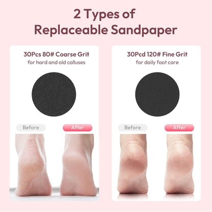Electric Foot Callus Remover, 2 in 1 Rechargeable Electric Callus Remover for Feet, Pedicure Tools with 70pcs Sandpapers, Professional Foot Scrubber File for Dead Skin - Pink